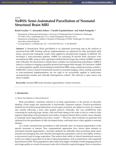 Automated Processing Pipeline For Neonatal Diffusion Mri In The Developing Human Connectome Project